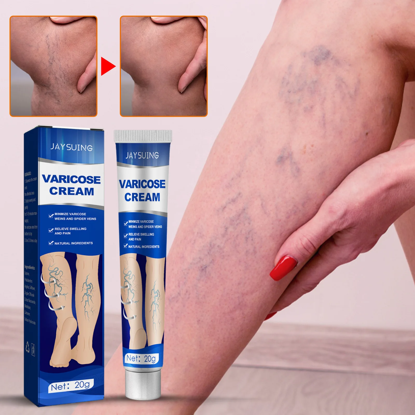 Effective Varicose Veins Relief Cream Relieve Leg Tired Vasculitis Phlebitis Spider Varicosity Angiitis Removal Health Body Care
Effective Varicose Veins Relief Cream Relieve Leg Tired Vasculitis Phlebitis Spider Varicosity Angiitis Removal Health Body Care