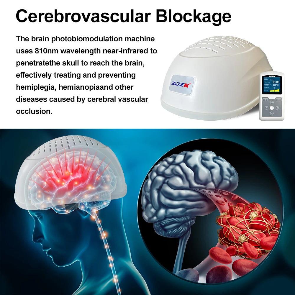 ZJZK Neuromodulacion Brain Wave Helmet 810nm*280diodes 15W Infrared LED Light Therapy For Parkinson Stroke Autism Migraine
ZJZK Neuromodulacion Brain Wave Helmet 810nm*280diodes 15W Infrared LED Light Therapy For Parkinson Stroke Autism Migraine