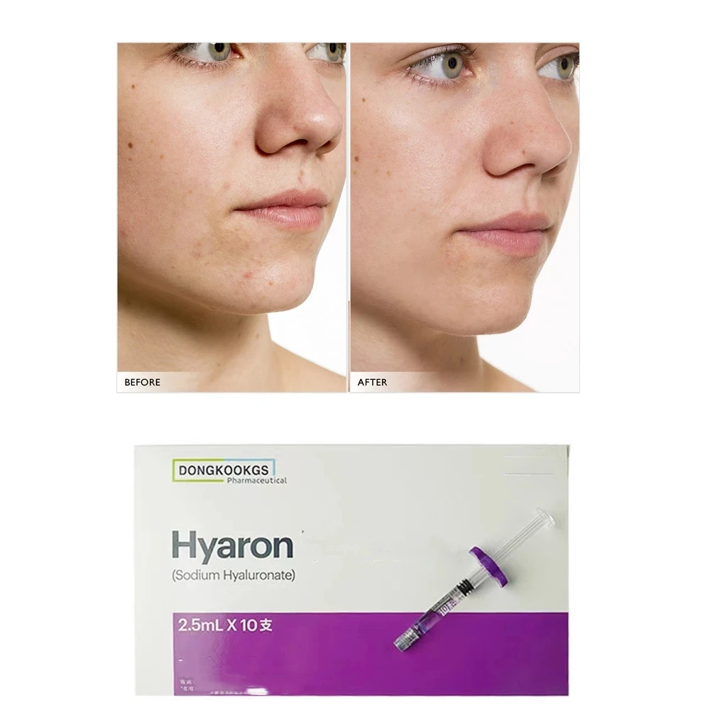 Hyaron2.5ml Face Wrinkles Removal Skin Nourishing Enhancement Volume Collagen Regeneration
Hyaron2.5ml Face Wrinkles Removal Skin Nourishing Enhancement Volume Collagen Regeneration