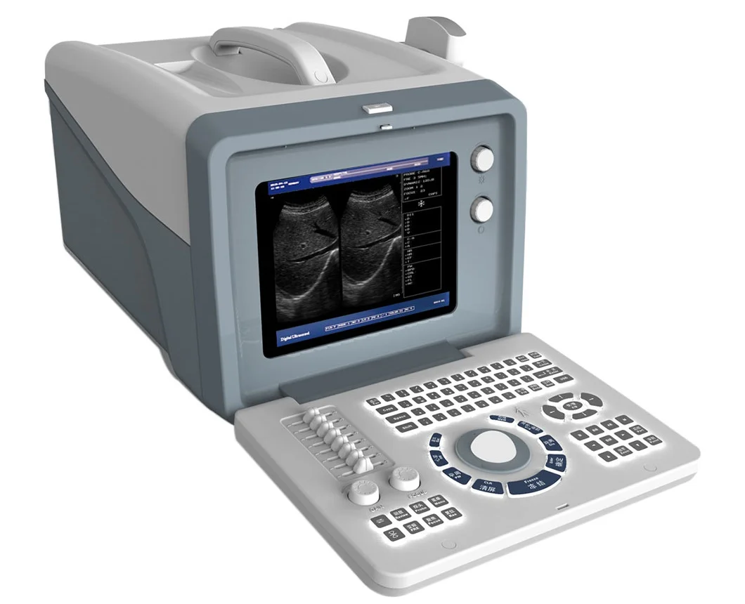 (%100)China Best Price Medical Hospital Diagnosis Equipment Portable Ultrasound Scanner
(%100)China Best Price Medical Hospital Diagnosis Equipment Portable Ultrasound Scanner
