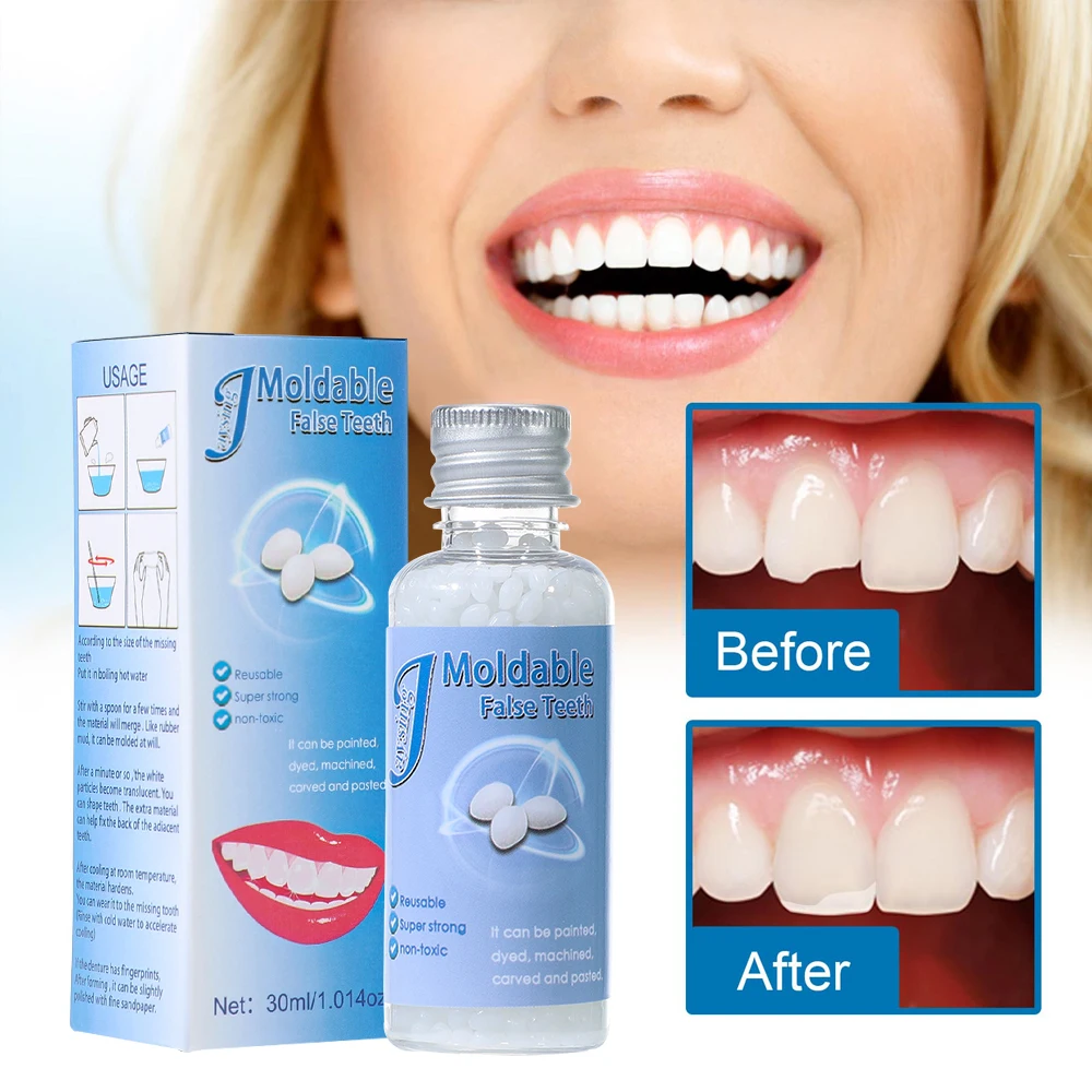 

Solid Teething Gum Temporary Tooth Kit Repair Teeth Gaps Filling False Teeth Solid Glue Denture Adhesive Beauty Teeth Whitening