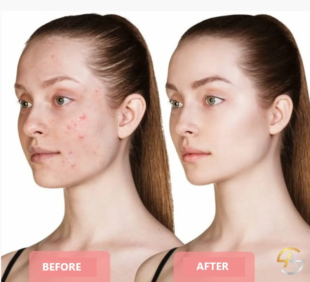Sunscreens Beauty and Health Makeup Removal Blackhead Revitalization Moisturizer
Sunscreens Beauty and Health Makeup Removal Blackhead Revitalization Moisturizer