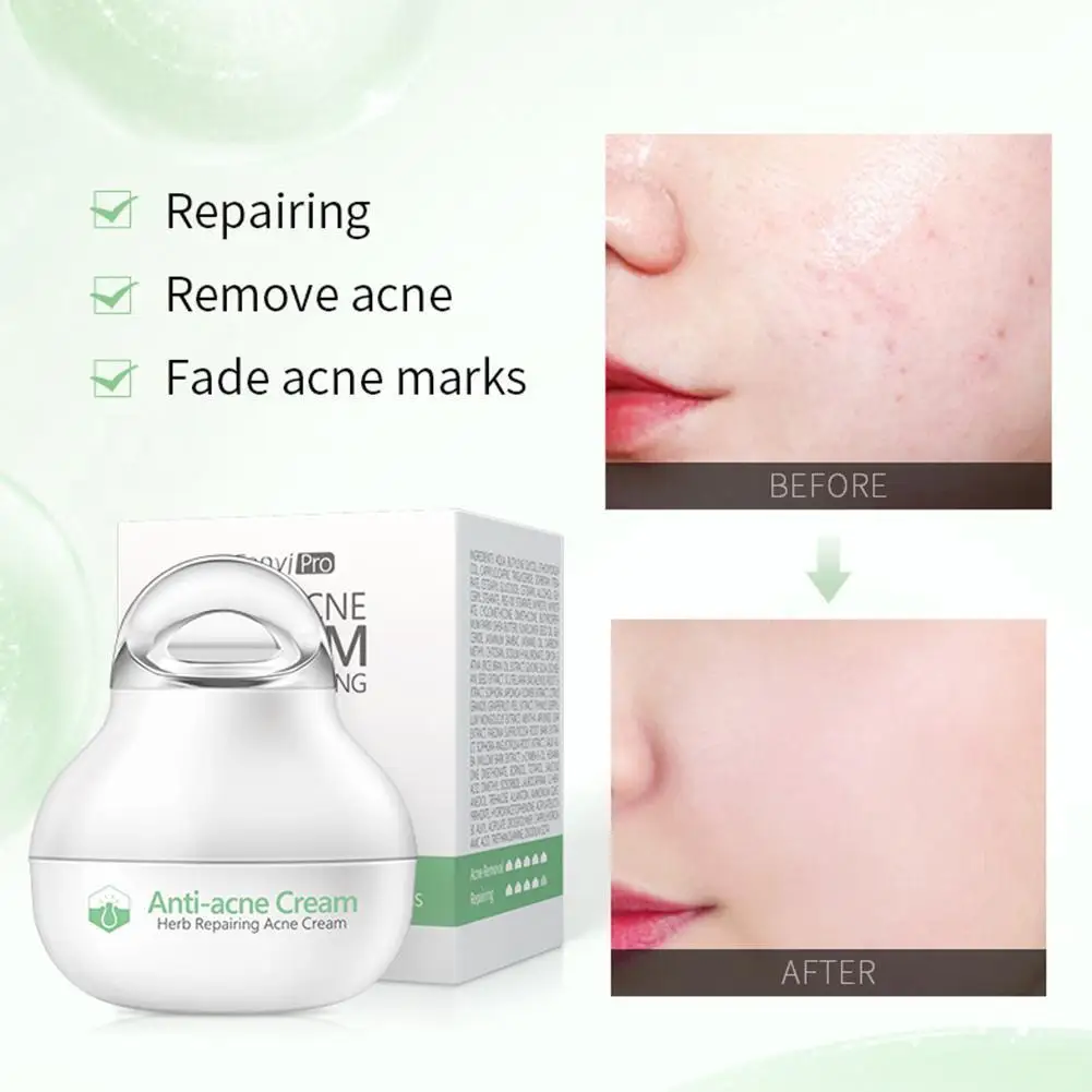 Effective Anti-Acne Cream Acne Treatment Fade Acne Spots Oil Control Shrink Pores Whitening Moisturizing Acne Cream Skin Care
Effective Anti-Acne Cream Acne Treatment Fade Acne Spots Oil Control Shrink Pores Whitening Moisturizing Acne Cream Skin Care