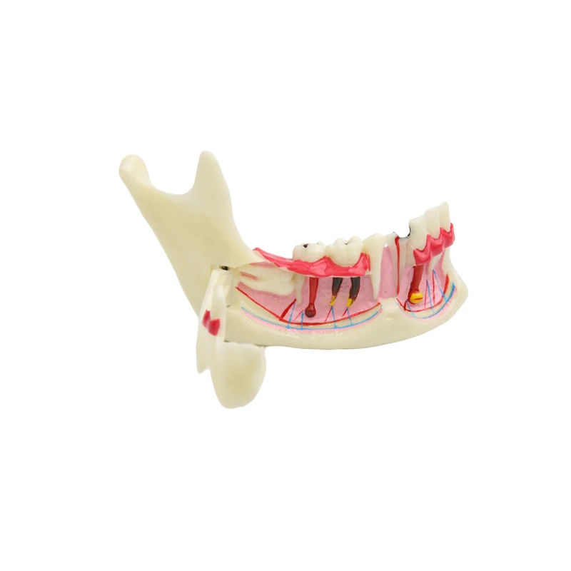 Модель для обучения стоматологии Mandibular, демонстрация зубов, анатомический пациент, 1 шт.
Модель для обучения стоматологии Mandibular, демонстрация зубов, анатомический пациент, 1 шт.