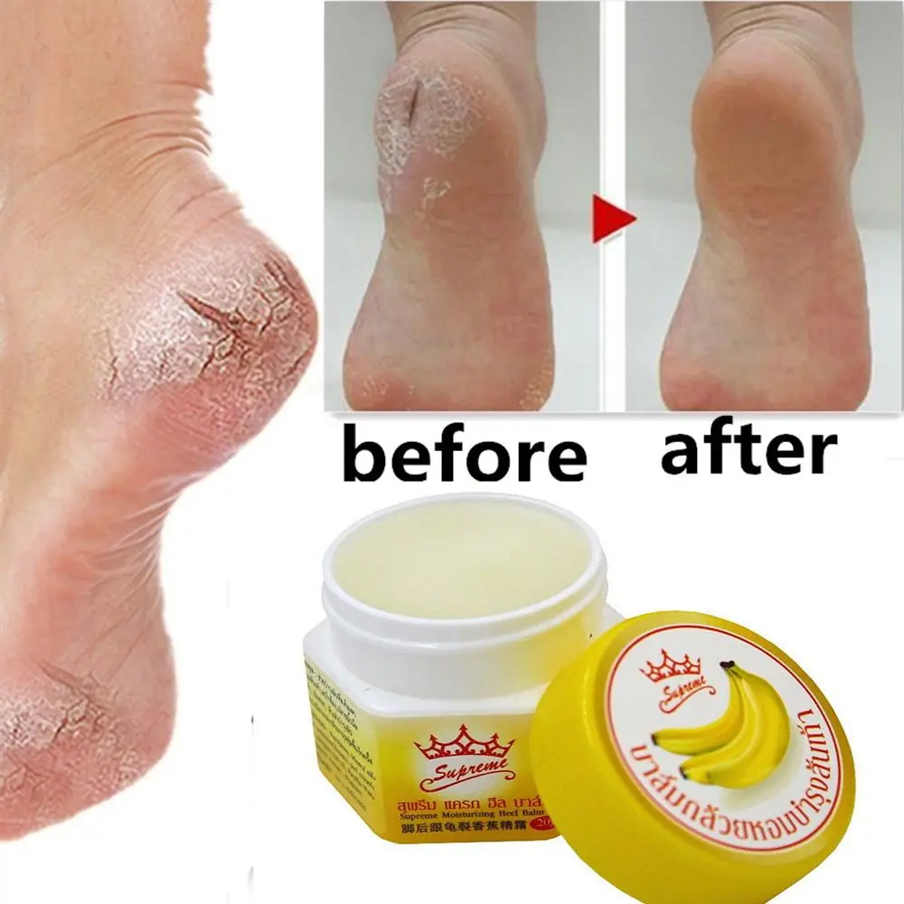 Cracked hands feet repair cream anti-fungal anti-chapped repairing banana oil massage cream nourishing gentle skin care
Cracked hands feet repair cream anti-fungal anti-chapped repairing banana oil massage cream nourishing gentle skin care