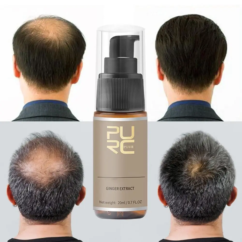 30ml Men Hair Growth Spray Hair Fast Repair Growing Treatment Liquid Extract Prevent Hair Loss Growing
30ml Men Hair Growth Spray Hair Fast Repair Growing Treatment Liquid Extract Prevent Hair Loss Growing