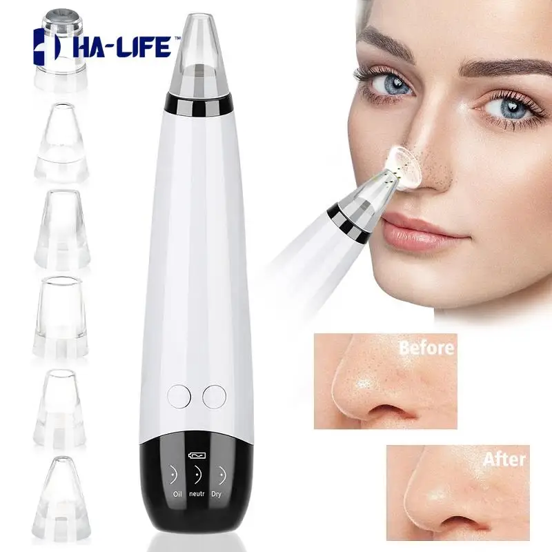 HA-Life Cleansing Blackhead Instrument Electric Blackhead Remover Facial Nose Cleansing Pore Acne Cleanser Pore
HA-Life Cleansing Blackhead Instrument Electric Blackhead Remover Facial Nose Cleansing Pore Acne Cleanser Pore