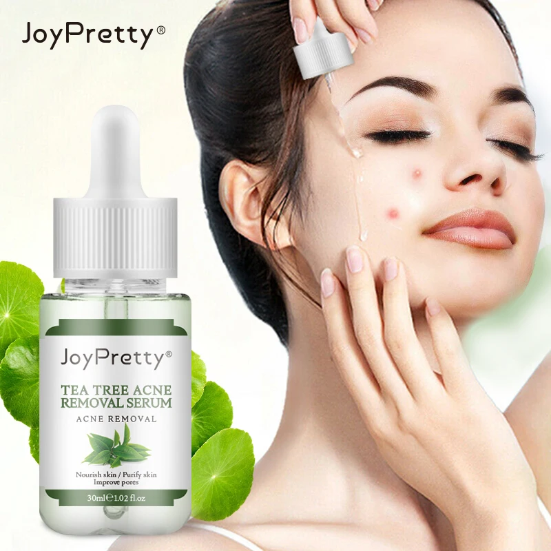 Facial Acne Treatment Serum Face Scar Pimple Removal Whitening Acne Remove acne Skin health care product 30ml
Facial Acne Treatment Serum Face Scar Pimple Removal Whitening Acne Remove acne Skin health care product 30ml
