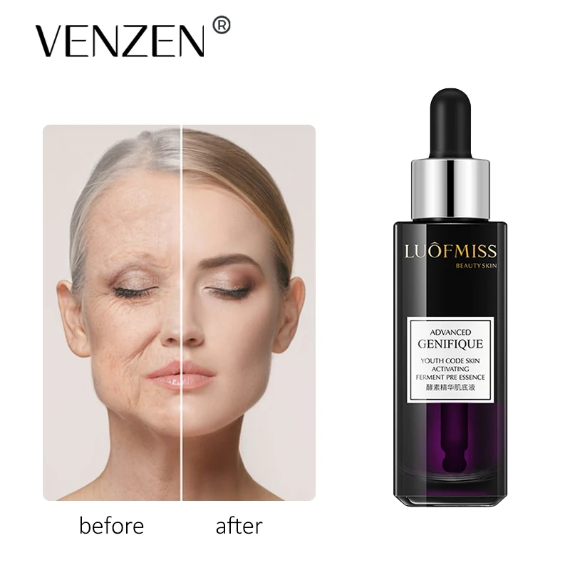 LOUFMISS Yeast Serum Nourish Essense Oil Control Brightening Rejuvenation Skin Whitening Serum Skin Care Facecare
LOUFMISS Yeast Serum Nourish Essense Oil Control Brightening Rejuvenation Skin Whitening Serum Skin Care Facecare