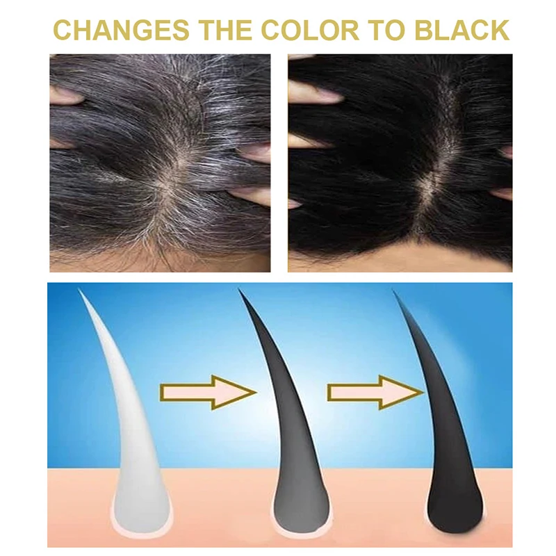 30/200ML Hair Loss Treatment Shampoo Hair Care Ginger Hair Growth Anti-hair Loss Hair Growth Cinnamon Polygonum Multiflorum
30/200ML Hair Loss Treatment Shampoo Hair Care Ginger Hair Growth Anti-hair Loss Hair Growth Cinnamon Polygonum Multiflorum