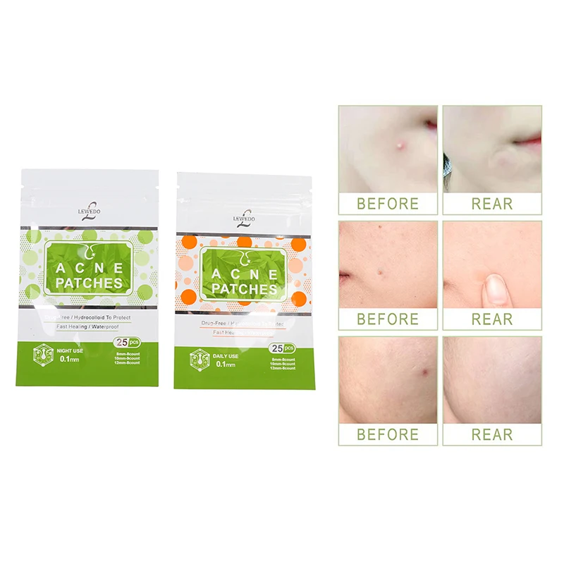 25Pcs/Sheet Acne Invisible Sticker Acne Skin Blemish Care Tool Acne Invisible Sticker Acne Skin Blemish Skin therapy Tool
25Pcs/Sheet Acne Invisible Sticker Acne Skin Blemish Care Tool Acne Invisible Sticker Acne Skin Blemish Skin therapy Tool