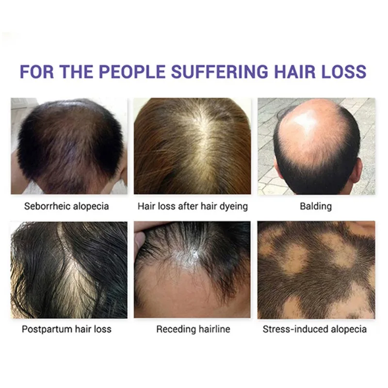 15ml For Dried and Damaged Hairs Nutrition Hair Treatment Oil Hair Fast Growth Essence Hairdressing Essential Oil
15ml For Dried and Damaged Hairs Nutrition Hair Treatment Oil Hair Fast Growth Essence Hairdressing Essential Oil