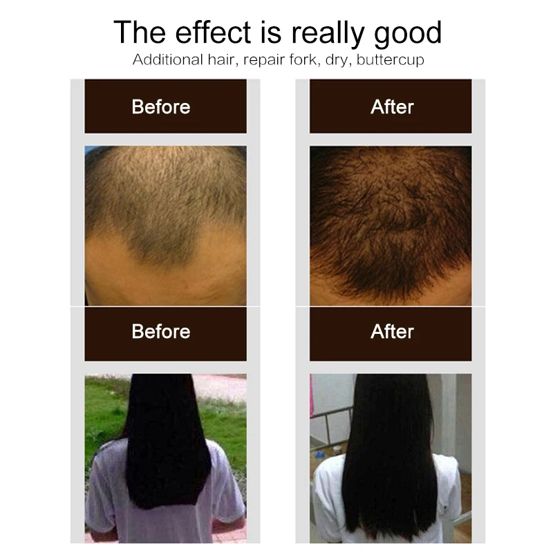 30ml Purc Hair Growth Spray Natural Ginger Essence Spray Effective Extract Anti Hair Loss Nourish Root Hair Care Treatment TSLM1 
30ml Purc Hair Growth Spray Natural Ginger Essence Spray Effective Extract Anti Hair Loss Nourish Root Hair Care Treatment TSLM1