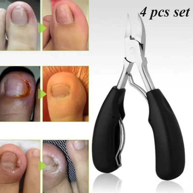 Nail Clipper 4Pcs Pedicure Manicure Hand Foot Care Tool Ingrown Toenail Cutters Correction Nippers Cuticle Cutters Nail Trimmer
Nail Clipper 4Pcs Pedicure Manicure Hand Foot Care Tool Ingrown Toenail Cutters Correction Nippers Cuticle Cutters Nail Trimmer