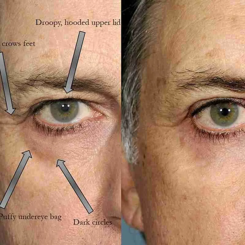 Men Eye Anti-aging Cream Dark Circle Remove Fades Care Lifting Fine Eyes Around Firming Lines Skin N4Q0
Men Eye Anti-aging Cream Dark Circle Remove Fades Care Lifting Fine Eyes Around Firming Lines Skin N4Q0