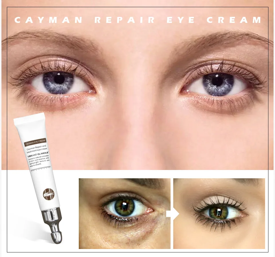 Moisturizing, hydrating, moisturizing and softening the skin crocodile repair eye cream, lifting up and diminishing dark circles
Moisturizing, hydrating, moisturizing and softening the skin crocodile repair eye cream, lifting up and diminishing dark circles