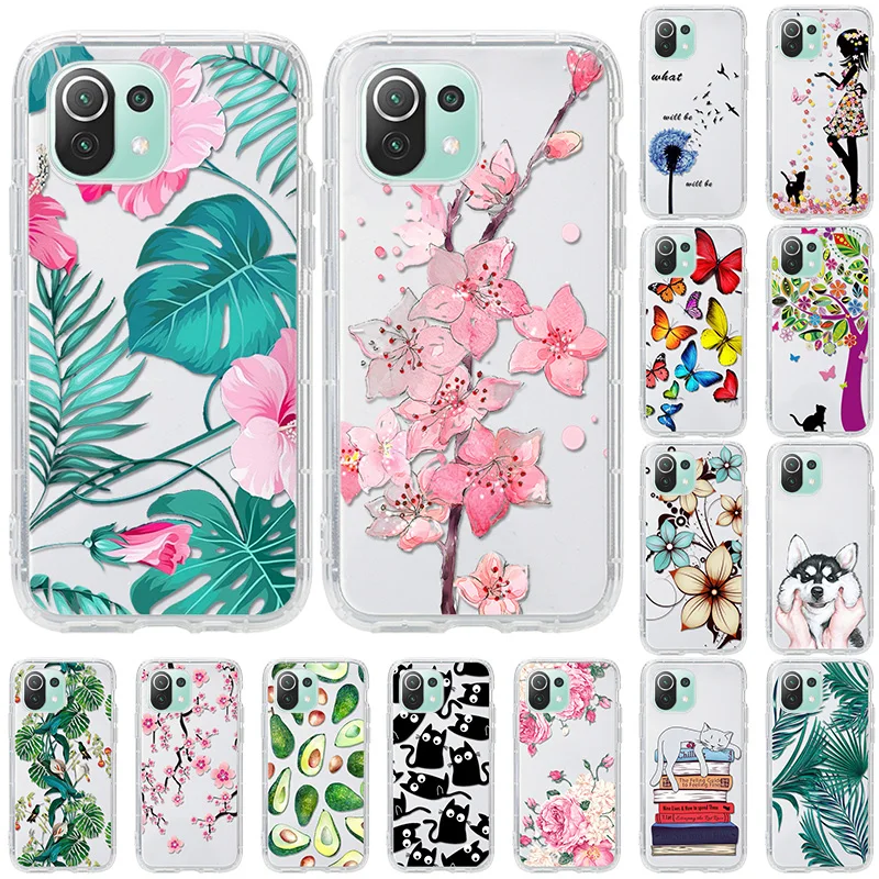 Transparent Case For Xiaomi Mi 11 Case Mi 10 Ultra 10T Lite Soft Cover For Xiaomi Mi Note 10 T Lite Poco X3 NFC M3 Pro F3 Cases
Transparent Case For Xiaomi Mi 11 Case Mi 10 Ultra 10T Lite Soft Cover For Xiaomi Mi Note 10 T Lite Poco X3 NFC M3 Pro F3 Cases