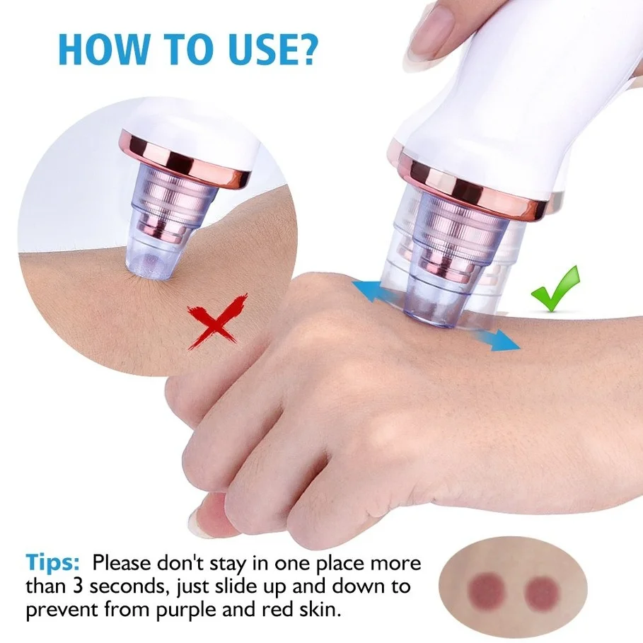 Blackhead Face Cleaner Vacuum Remover Vacuum Electric Pore Blackhead Comedone Acne Extractor Skin Care Tools Dropshipping
Blackhead Face Cleaner Vacuum Remover Vacuum Electric Pore Blackhead Comedone Acne Extractor Skin Care Tools Dropshipping