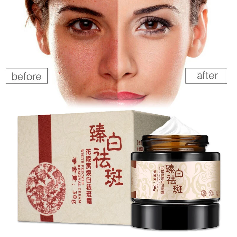 Крем для отбеливания и удаления веснушек, быстрое удаление пятен, отбеливание перманентных посторонних пятен, веснушек, темных пятен, уход ... 
Крем для отбеливания и удаления веснушек, быстрое удаление пятен, отбеливание перманентных посторонних пятен, веснушек, темных пятен, уход ...