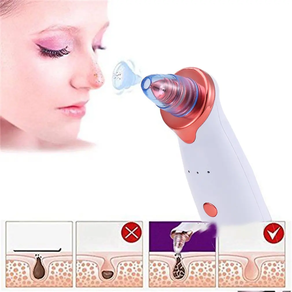 Comedo Blackhead Vacuum Suction Diamond Dermabrasion Removal Scar Acne Pore Peeling Face Clean Facial Skin Care Machine Dropping
Comedo Blackhead Vacuum Suction Diamond Dermabrasion Removal Scar Acne Pore Peeling Face Clean Facial Skin Care Machine Dropping