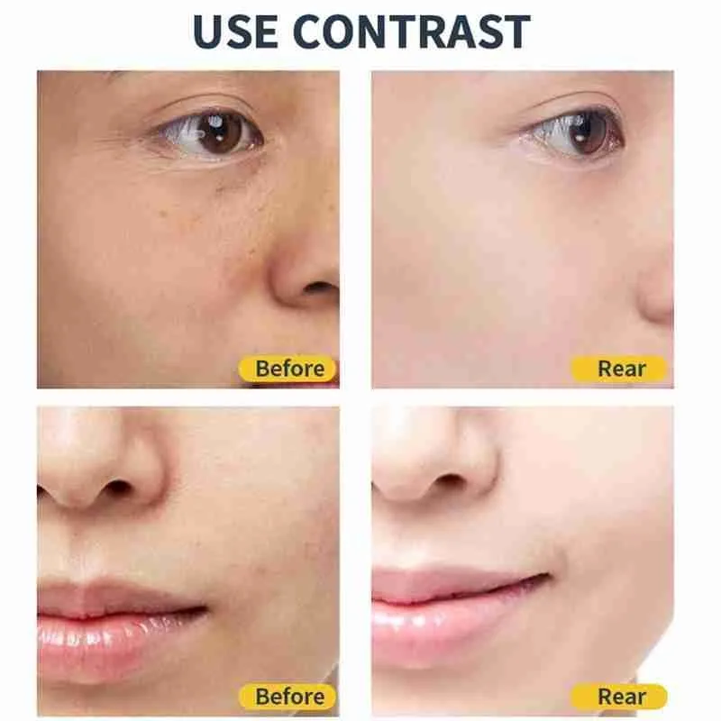 50mlvc Cream Anti-aging Fades Fine Lines Brightening Whitening Moisturizing Cream Skin Care Moisturizing L6U5
50mlvc Cream Anti-aging Fades Fine Lines Brightening Whitening Moisturizing Cream Skin Care Moisturizing L6U5