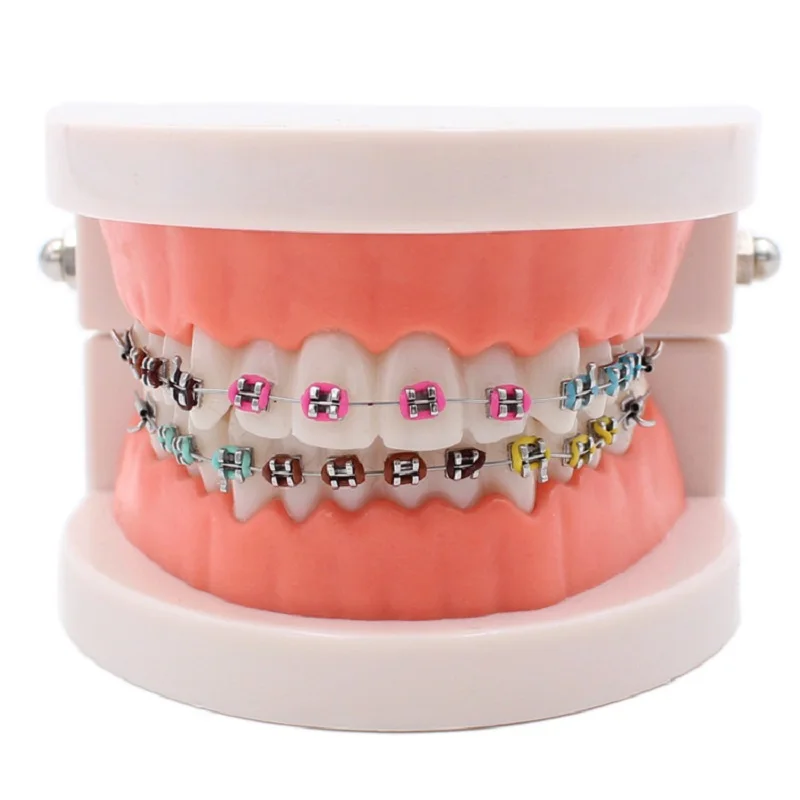 Dental Orthodontic Treatment Model With Ortho Metal Ceramic Bracket Arch Wire Buccal Tube Ligature Ties Dentist Tools Lab
Dental Orthodontic Treatment Model With Ortho Metal Ceramic Bracket Arch Wire Buccal Tube Ligature Ties Dentist Tools Lab