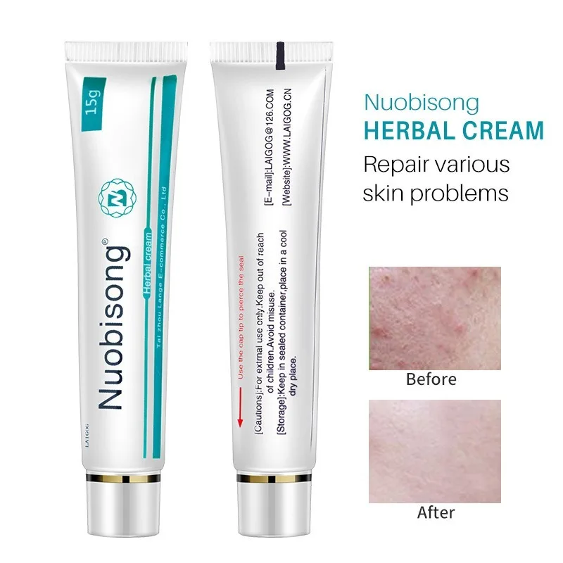 Nuobisong face skin care treatment face Pimples scar Stretch Marks removal acne treatment whitening moisturizing cream
Nuobisong face skin care treatment face Pimples scar Stretch Marks removal acne treatment whitening moisturizing cream