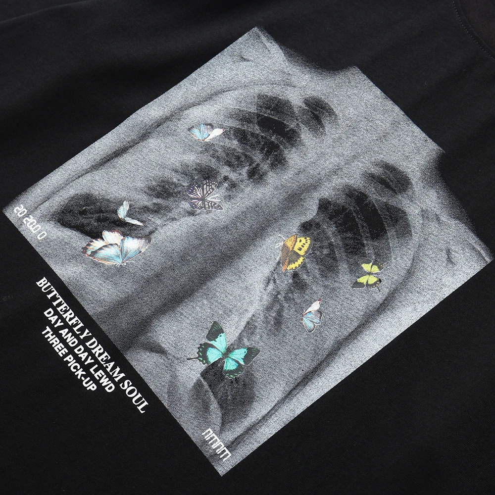X-ray men's short sleeve T-shirt loose clothes trend pure cotton top half sleeve large t-shirt men's new summer Butterfly
X-ray men's short sleeve T-shirt loose clothes trend pure cotton top half sleeve large t-shirt men's new summer Butterfly
