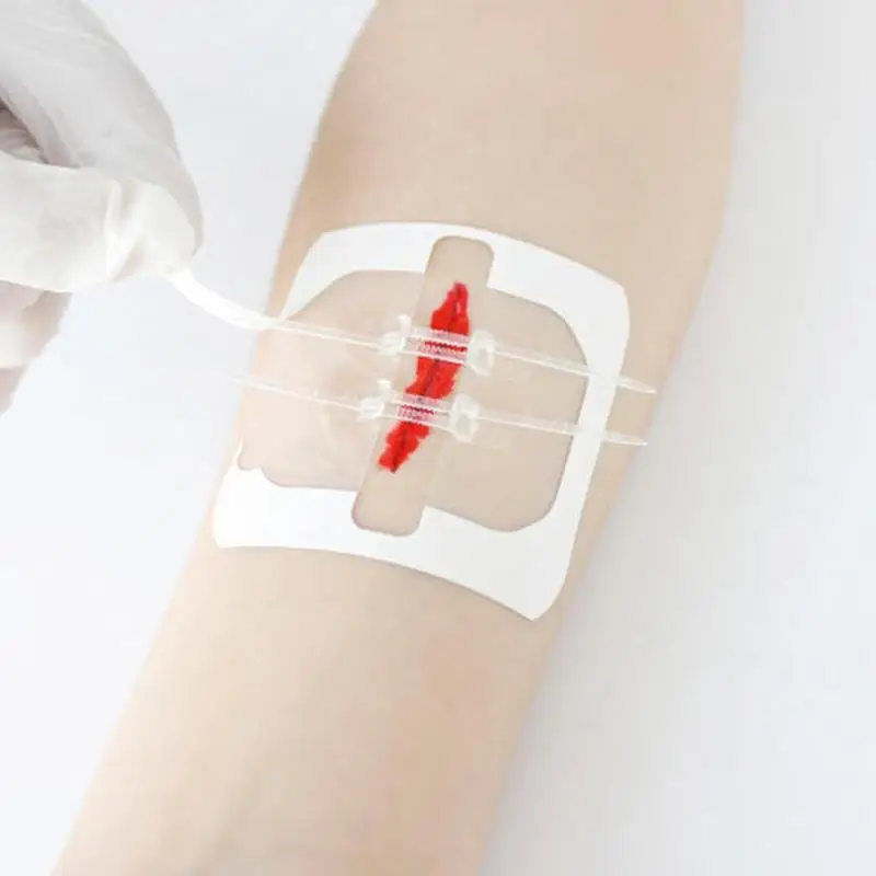 1pc Zipper Band-aid Painless Wound Closure Device Without Needles Suture-free Wound Dressing Patch Zip Suture Reducer Band Aid
1pc Zipper Band-aid Painless Wound Closure Device Without Needles Suture-free Wound Dressing Patch Zip Suture Reducer Band Aid