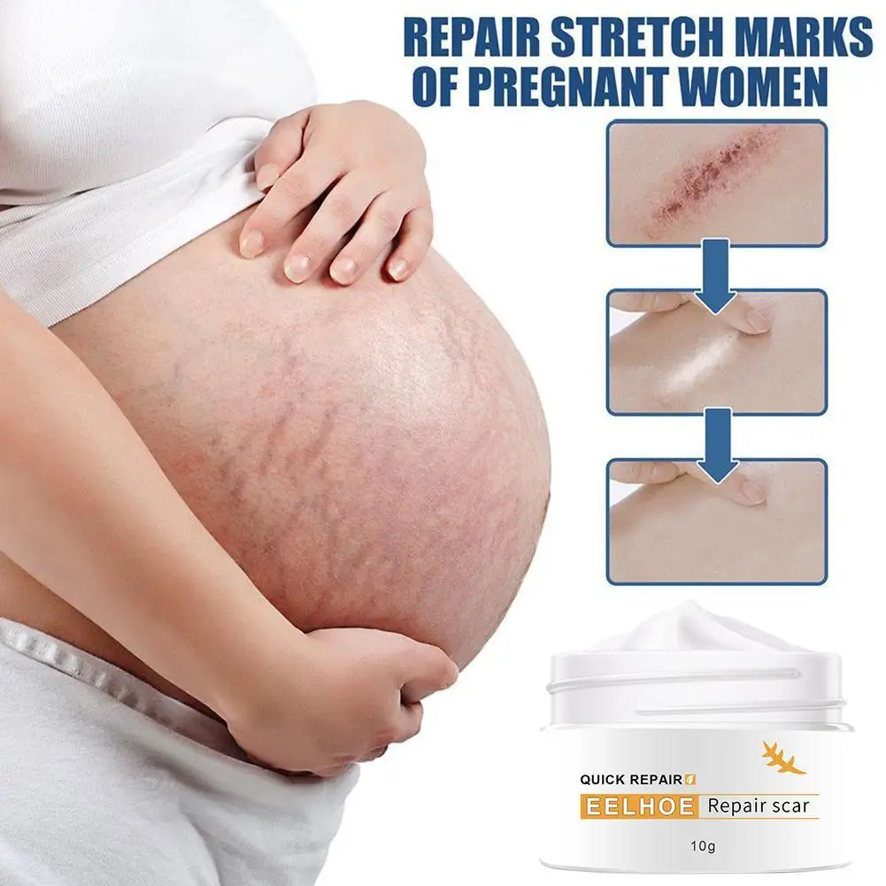 50g Repair Scar Cream Skin Care Body Cream Stretch Cream Repair Marks Scar Marks Scald Fade Striae Cream Removal Scar Pregn C7R9
50g Repair Scar Cream Skin Care Body Cream Stretch Cream Repair Marks Scar Marks Scald Fade Striae Cream Removal Scar Pregn C7R9