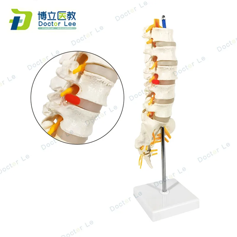 Life Size Inflexible Plastic Lumbar Vertebra Model with Spinal Nerves and Open Sacrum Bone for Medical Teaching
Life Size Inflexible Plastic Lumbar Vertebra Model with Spinal Nerves and Open Sacrum Bone for Medical Teaching