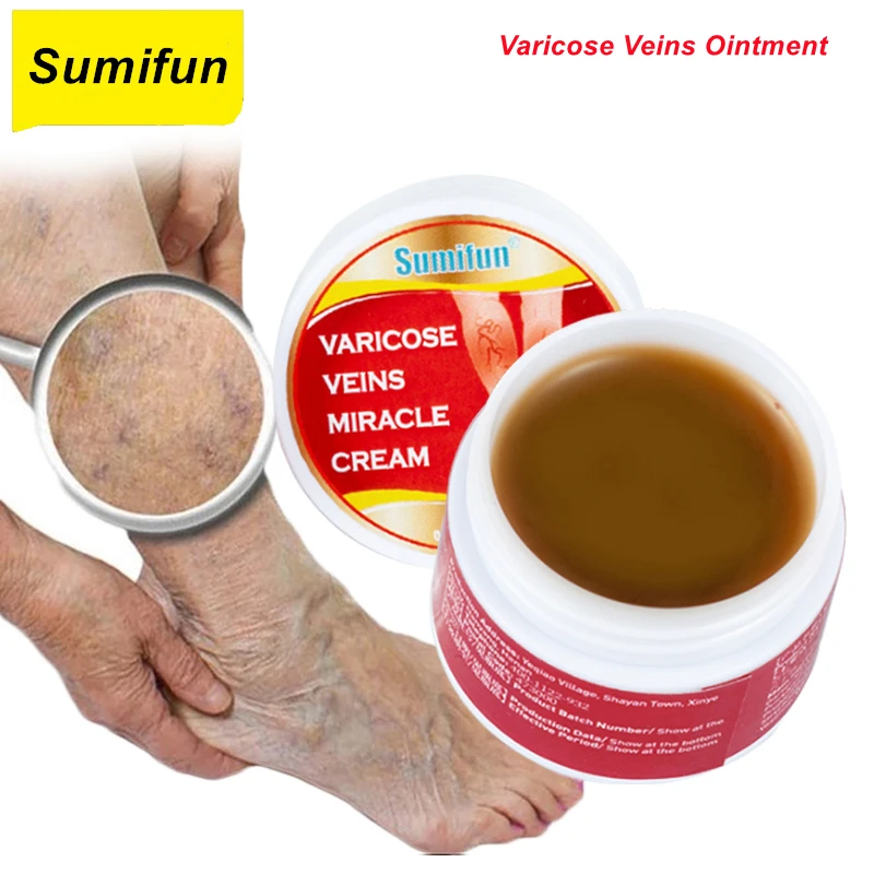 Varicose Veins Ointment Original Vasculitis Phlebitis Spider Treatment Cream Medical Plaster Skin Care Varicose Veins Ointment
Varicose Veins Ointment Original Vasculitis Phlebitis Spider Treatment Cream Medical Plaster Skin Care Varicose Veins Ointment