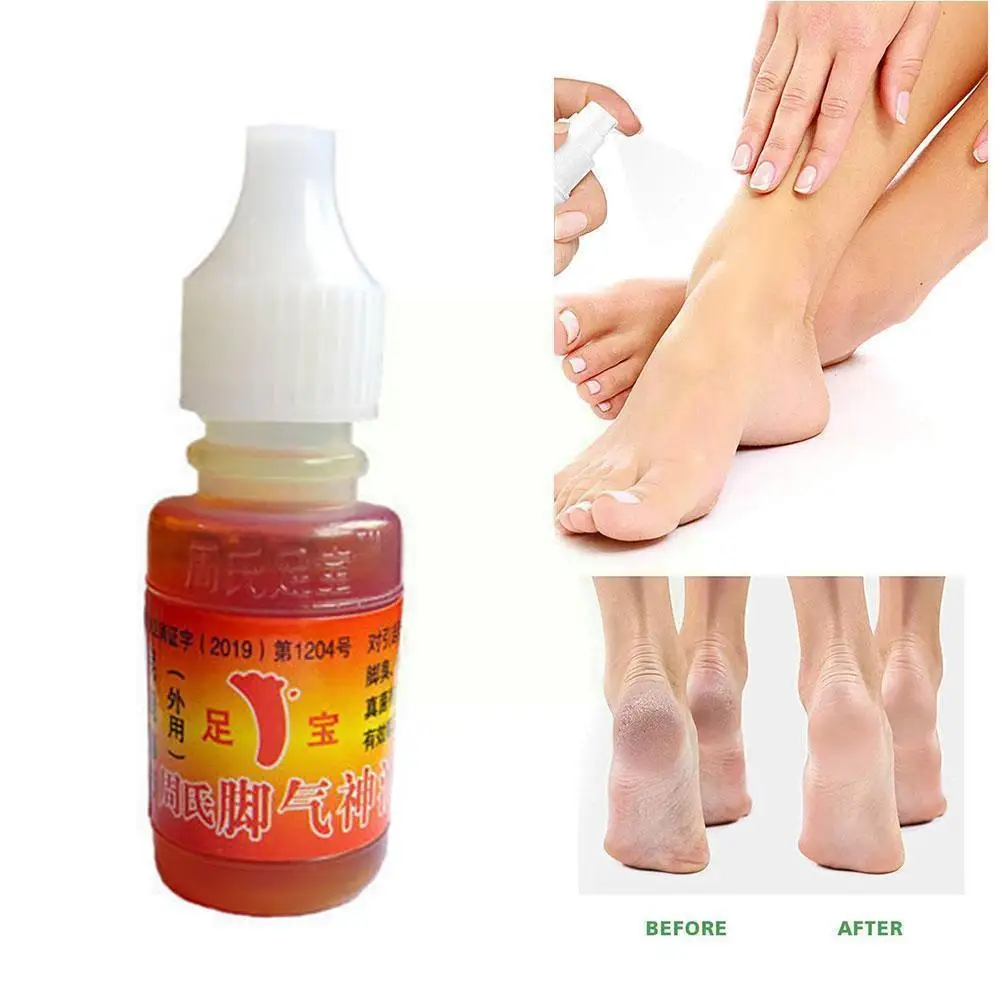 15ml Athlete's Foot Oil Remove Odor And Itchy Feet Chinese Anti-itch Bacterial Anti Itching Foot Care Beriberi Cream Medica V5a5
15ml Athlete's Foot Oil Remove Odor And Itchy Feet Chinese Anti-itch Bacterial Anti Itching Foot Care Beriberi Cream Medica V5a5