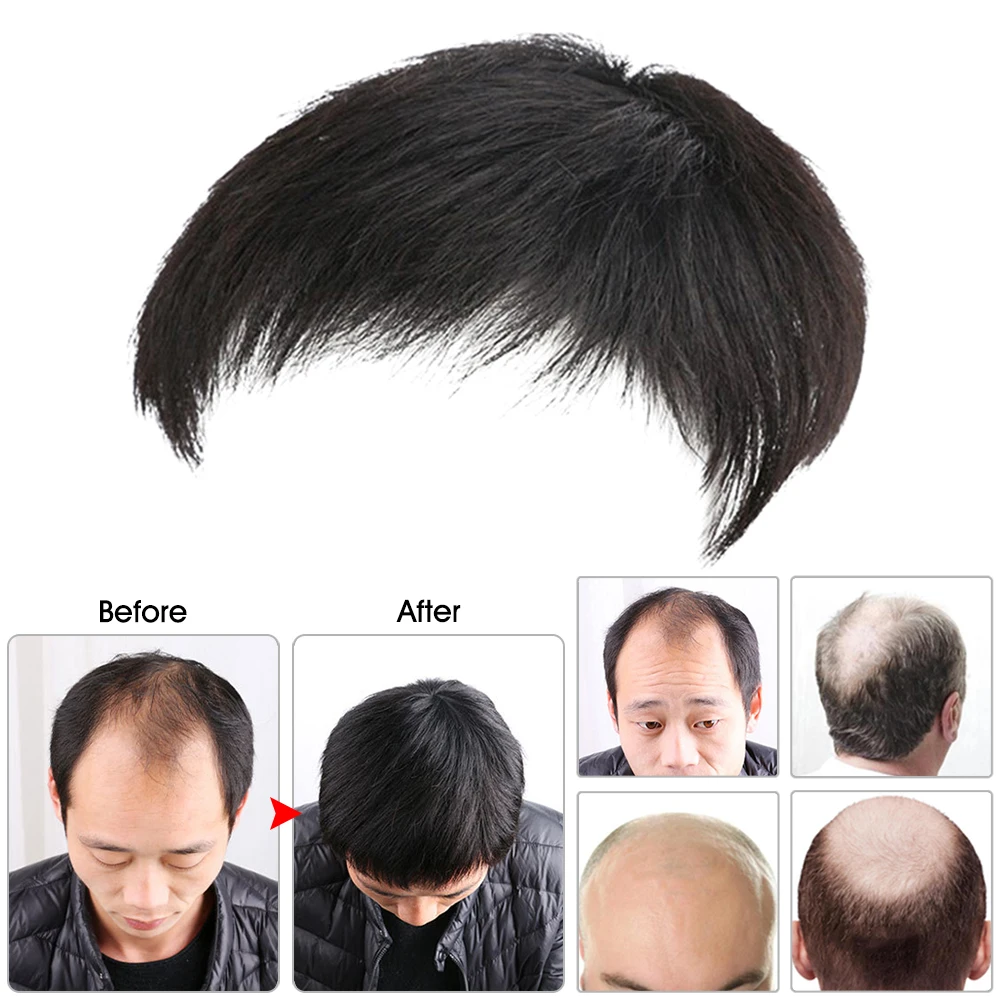 Mens Wig Black Short Wig Natural Layered Daily Wear Toupee Fake Hair Wig men's toupee by Men's Hair Loss
Mens Wig Black Short Wig Natural Layered Daily Wear Toupee Fake Hair Wig men's toupee by Men's Hair Loss