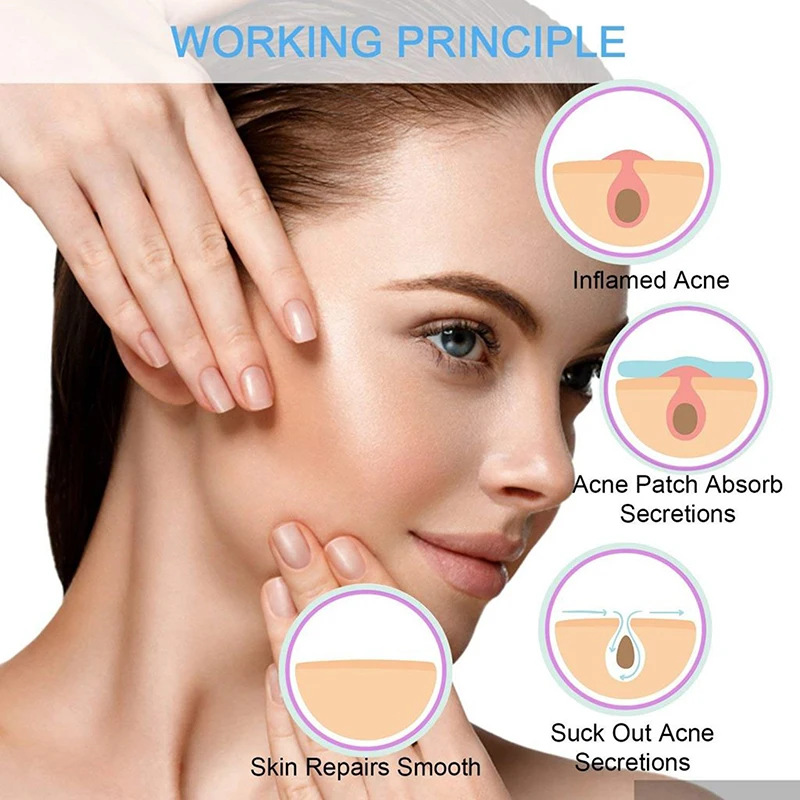36pcs Acne Patch Treatment Skin Care Face Pimple Master Remover Sticker Patch Facial Cover Patches Skin Tag
36pcs Acne Patch Treatment Skin Care Face Pimple Master Remover Sticker Patch Facial Cover Patches Skin Tag