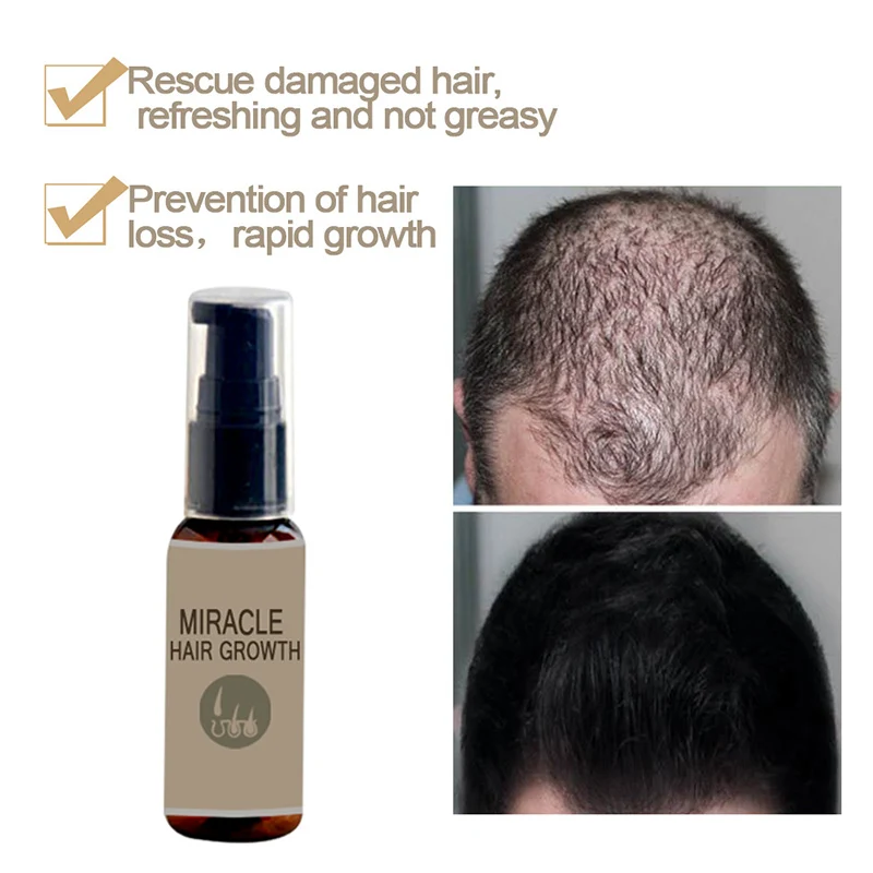 Hair Growth Liquid for All Hair Types Thicken Rapidly Stimulates Faster Growth Solution EY669
Hair Growth Liquid for All Hair Types Thicken Rapidly Stimulates Faster Growth Solution EY669