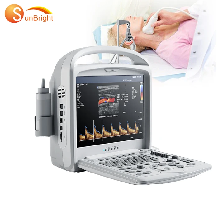 color doppler CE digital portable color doppler ultrasound medical equipment/cheap doppler ultrasound machine scanner price
color doppler CE digital portable color doppler ultrasound medical equipment/cheap doppler ultrasound machine scanner price