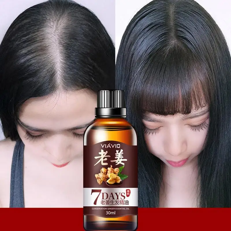 30ml 7 Days Ginger Hair Oil Growth Essential Oil healthy hair Growth Serum Treatment Hair Growth Nourish the scalp Essential Oil
30ml 7 Days Ginger Hair Oil Growth Essential Oil healthy hair Growth Serum Treatment Hair Growth Nourish the scalp Essential Oil