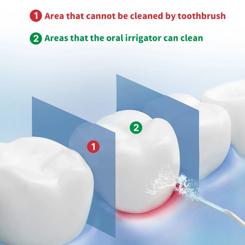 Oral Irrigator USB Rechargeable Water Flosser Portable Dental Water Jet IPX7 cleaning electric dental irrigator dental cleaning 
Oral Irrigator USB Rechargeable Water Flosser Portable Dental Water Jet IPX7 cleaning electric dental irrigator dental cleaning