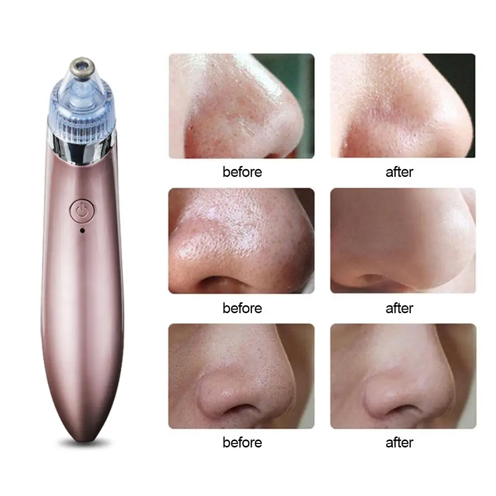 Blackhead Remover Face Deep Nose Cleaner T Zone Pore Acne Pimple Removal Vacuum Suction Facial Diamond Beauty Clean Skin Tool
Blackhead Remover Face Deep Nose Cleaner T Zone Pore Acne Pimple Removal Vacuum Suction Facial Diamond Beauty Clean Skin Tool