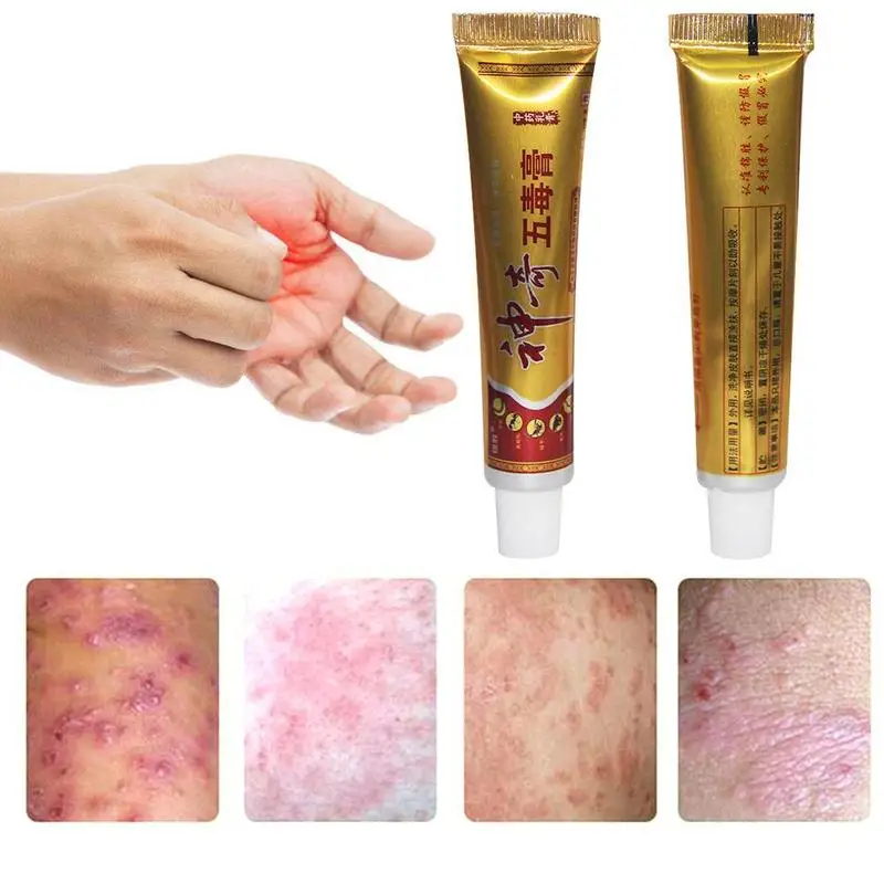 Psoriasis and Eczema Antibacterial Ointment Rotten Foot Peeling Anti-itch Blisters Foot Cream Pain Cream Skin Problems
Psoriasis and Eczema Antibacterial Ointment Rotten Foot Peeling Anti-itch Blisters Foot Cream Pain Cream Skin Problems