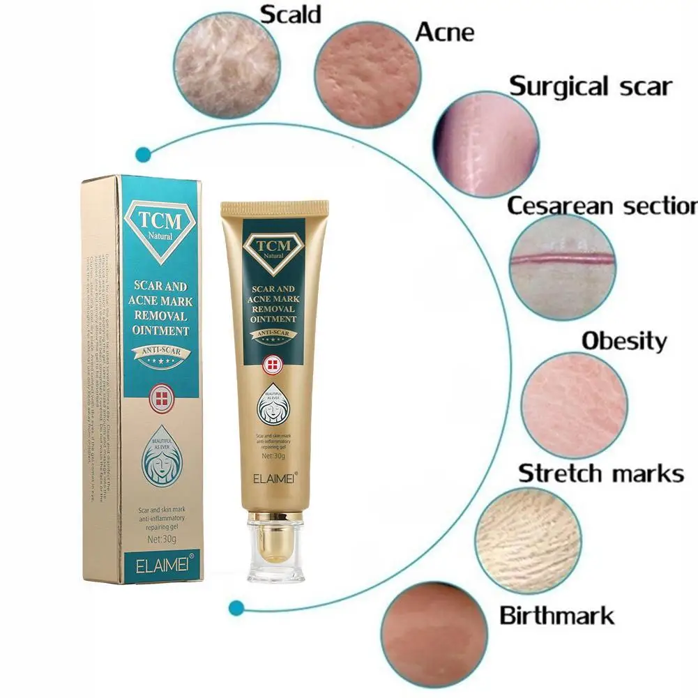30g Acne Scar Removal Cream Pimples Stretch Marks Face Gel Remove Acne Smoothing Whitening Moisturizing Body Skin Care
30g Acne Scar Removal Cream Pimples Stretch Marks Face Gel Remove Acne Smoothing Whitening Moisturizing Body Skin Care