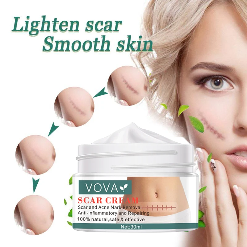 VOVA 30g Acne Scar Removal Cream Pimples Stretch Marks Face Gel Remove Acne Smoothing Whitening Moisturizing Body Skin Care
VOVA 30g Acne Scar Removal Cream Pimples Stretch Marks Face Gel Remove Acne Smoothing Whitening Moisturizing Body Skin Care