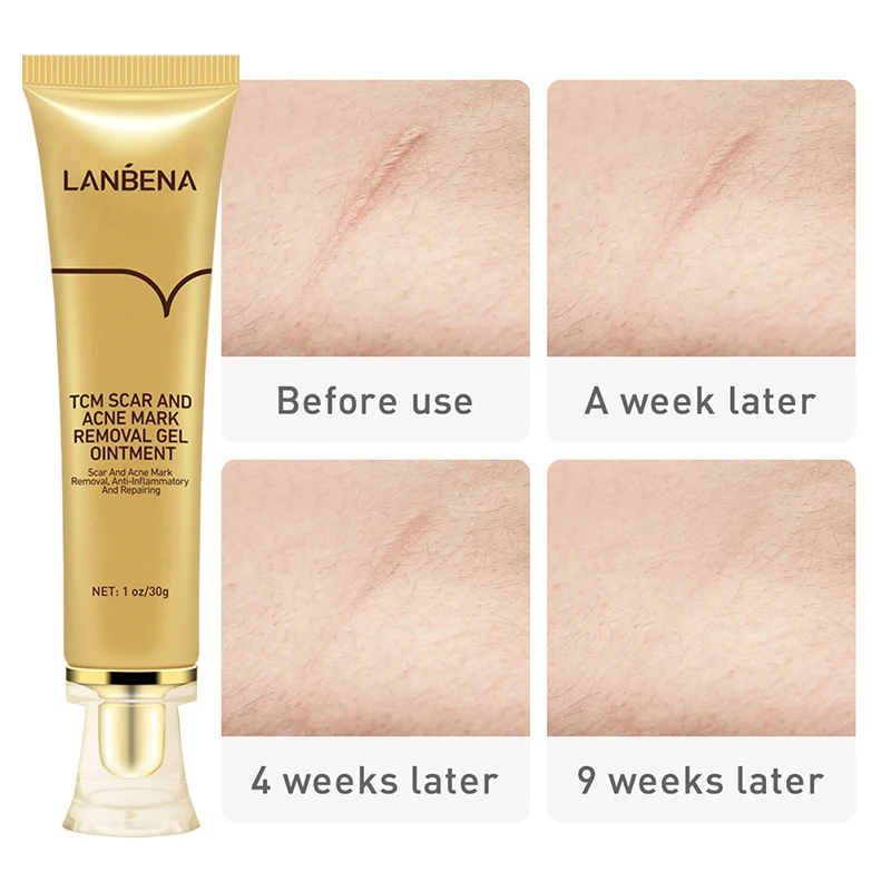Chinese Medicine Scar Acne Mark Removal Gel Repair Skin Fade Hyperplastic Scar Surgical Scar Burns Scalds Treatment Cream 30g
Chinese Medicine Scar Acne Mark Removal Gel Repair Skin Fade Hyperplastic Scar Surgical Scar Burns Scalds Treatment Cream 30g