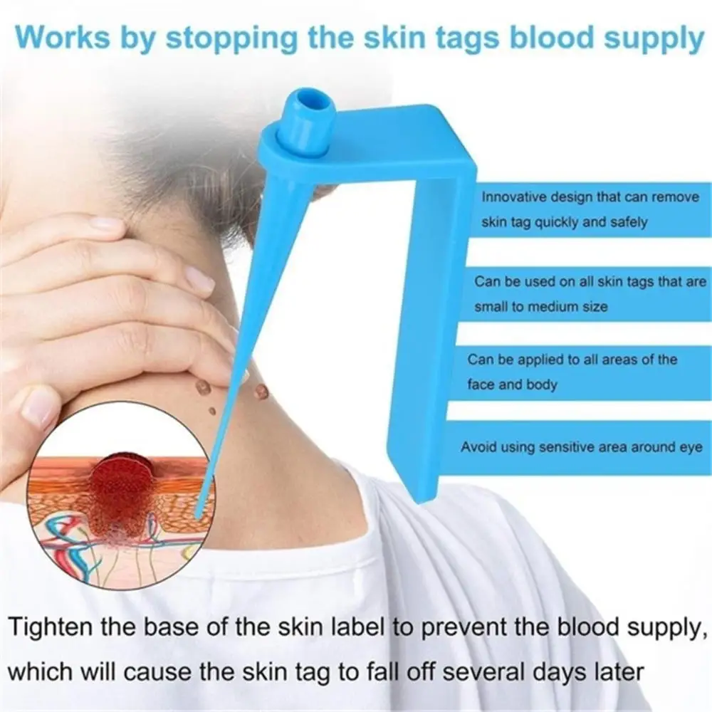 Micro Band Non Toxic Face Care Mole Wart Tool For Small To Medium Blue Skin Tag Removal Kit With Cleansing Swabs Home Use Adult
Micro Band Non Toxic Face Care Mole Wart Tool For Small To Medium Blue Skin Tag Removal Kit With Cleansing Swabs Home Use Adult