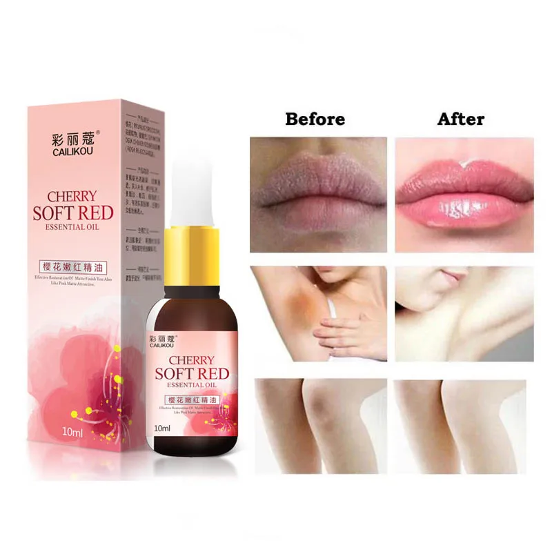 Quick Whitening & Moisturizer Fade Melanin Melasma Oil Ageless Skinfood Pink Tender Skin Care Cherry Pinkish Essence
Quick Whitening & Moisturizer Fade Melanin Melasma Oil Ageless Skinfood Pink Tender Skin Care Cherry Pinkish Essence