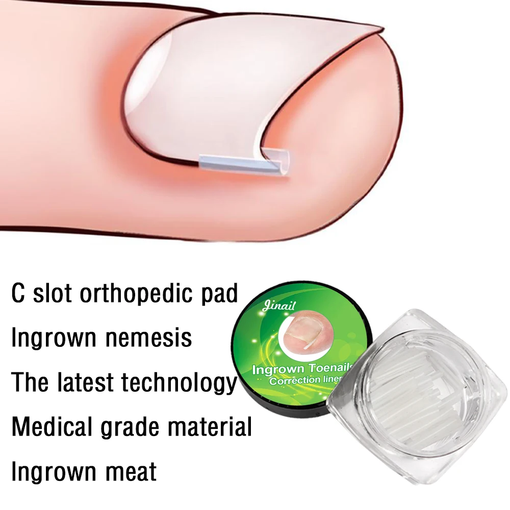 10pcs/set Ingrown Nail Pad Nail Filling Nail Groove Pad Ingrown Nail Corrector Ingrown Nail Artifact
10pcs/set Ingrown Nail Pad Nail Filling Nail Groove Pad Ingrown Nail Corrector Ingrown Nail Artifact