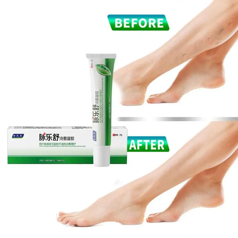 pain relief varicose veins herbal cream analgesic plaster ointment varicosity phlebite leg spider angiite remedy B6I7
pain relief varicose veins herbal cream analgesic plaster ointment varicosity phlebite leg spider angiite remedy B6I7