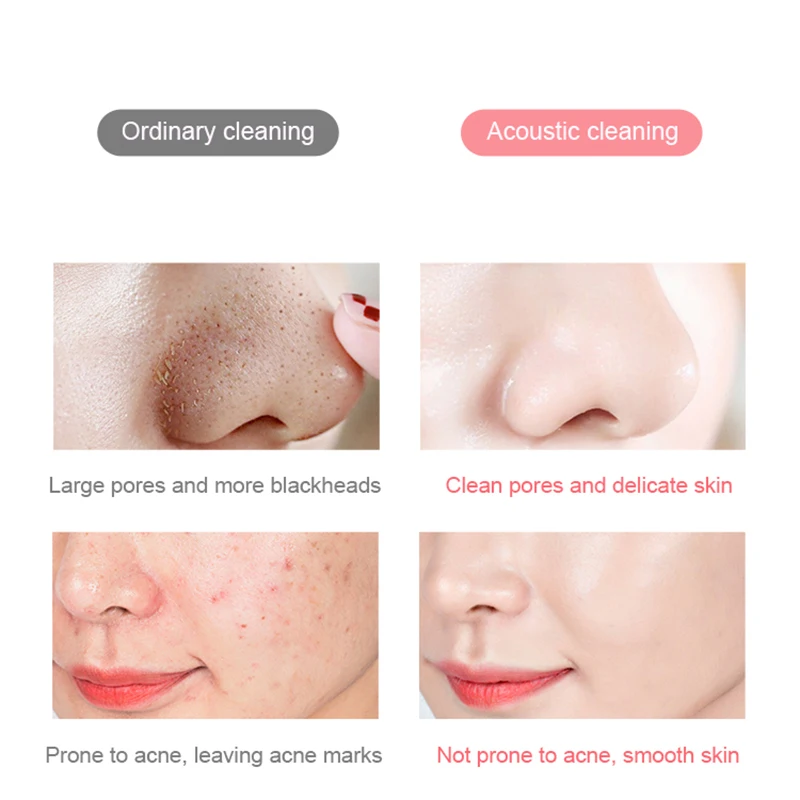 Portable Electric Facial Cleansing Brush IPX7 Waterproof USB Facial brush Untrasonic Cleanser Back Heat Face-lifting Massage
Portable Electric Facial Cleansing Brush IPX7 Waterproof USB Facial brush Untrasonic Cleanser Back Heat Face-lifting Massage