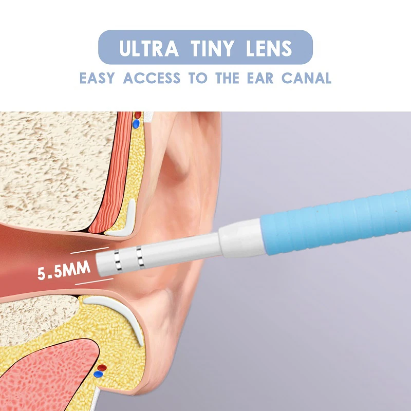 

5.5mm Ear Cleaner Otoscope 3 in 1 Visual Ear Picker HD720P 1.3MP Endoscope Camera Visual Otoscope Medical Ear Pick 2m Cable